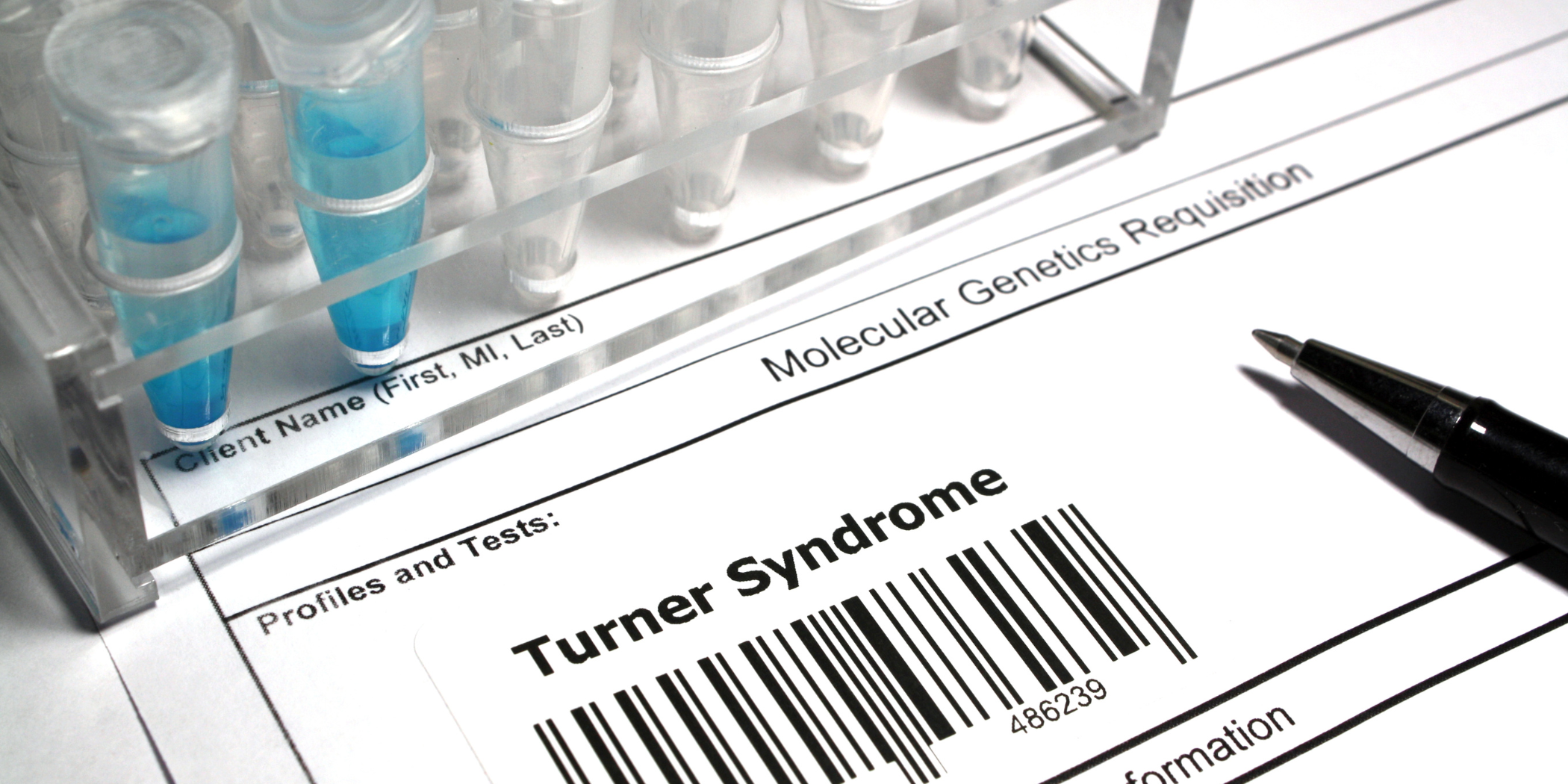 Understanding What Is Turner Syndrome - Insights and Perspectives