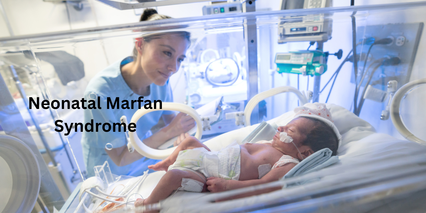 Understanding Neonatal Marfan Syndrome